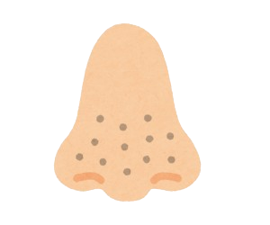 Blackheads/Open pores