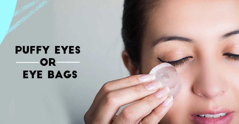 How to Get Rid of Puffy Eyes