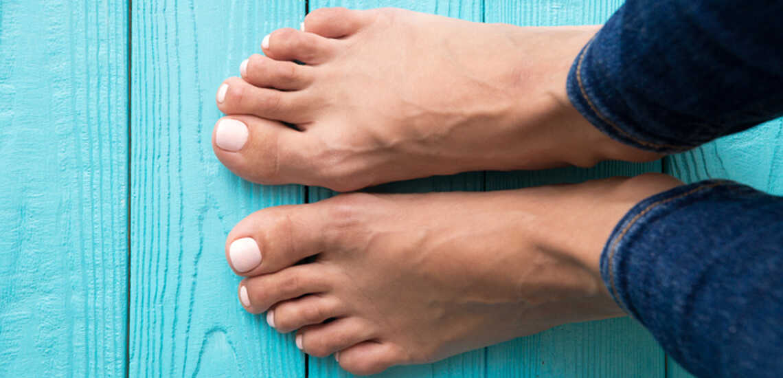 How to Get Rid of Calluses on Feet