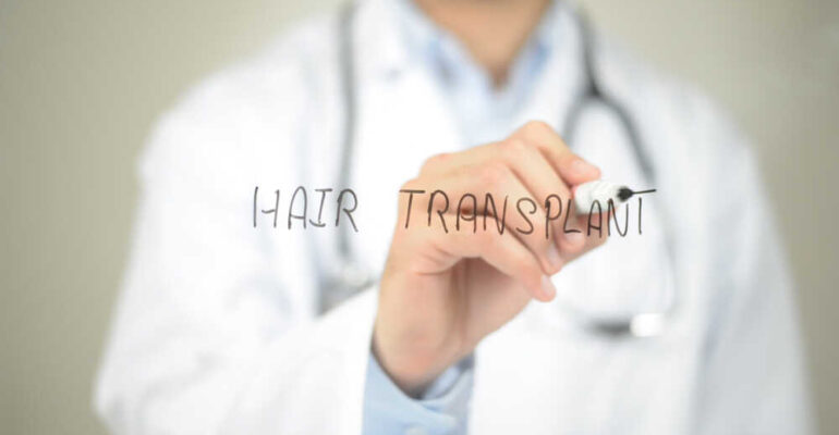 Hair Transplant