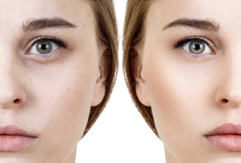 Comparison portrait of young woman before and after retouch.