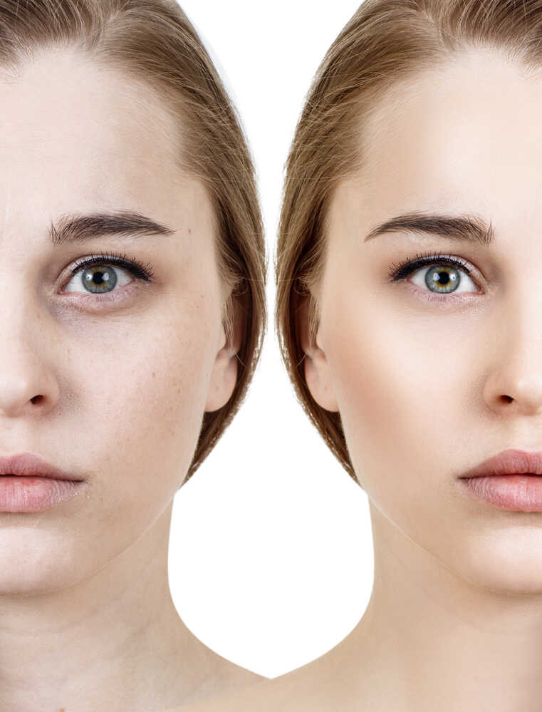 Comparison portrait of young woman before and after retouch.