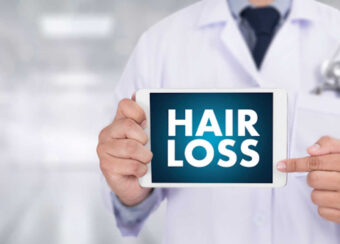 HAIR LOSS  scheme  Growth problem  Medical  Doctor concept