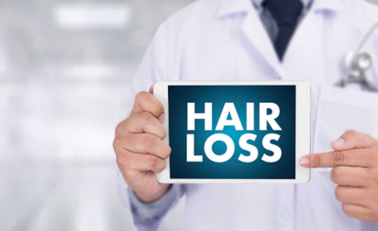 HAIR LOSS  scheme  Growth problem  Medical  Doctor concept