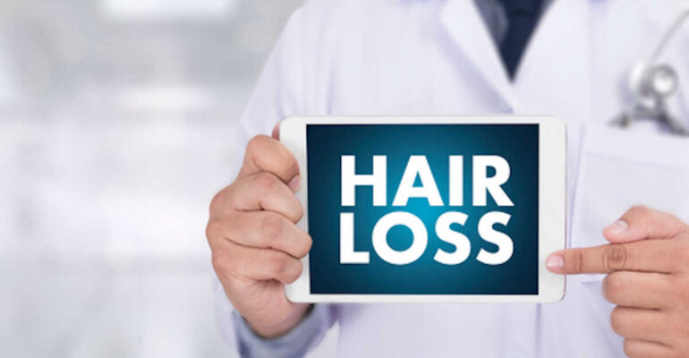 HAIR LOSS  scheme  Growth problem  Medical  Doctor concept