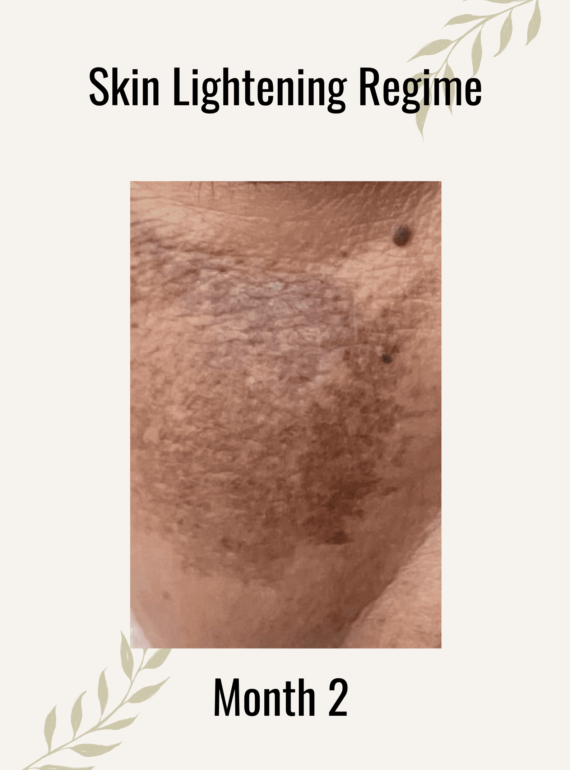 Skin-lightening-regime-month-2