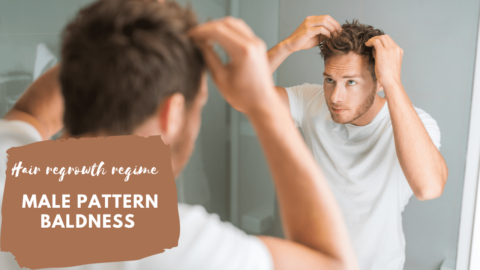 male pattern baldness