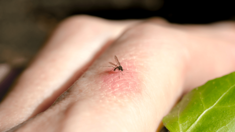 Insect bite